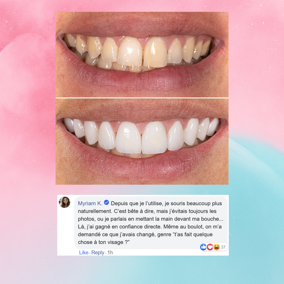 DuoWhite™ Dentifrice Blanchissant