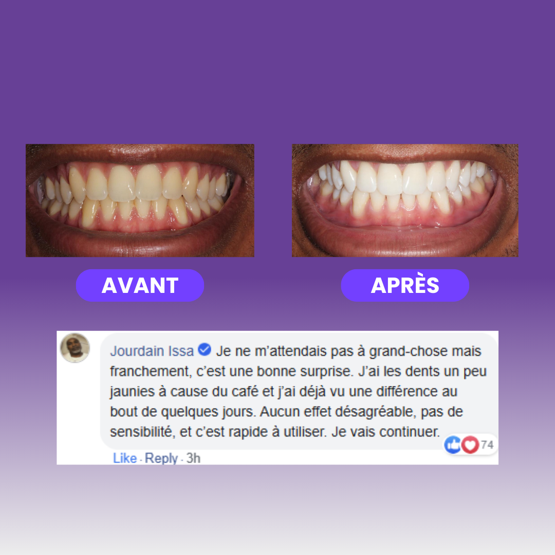 SKEEN™ Poudre Blanchissante Violette