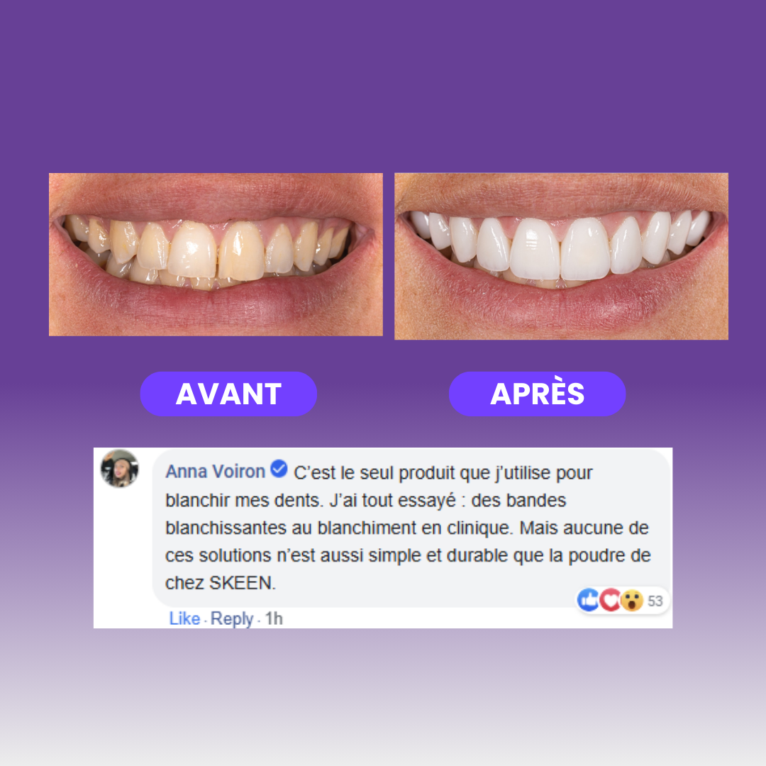 SKEEN™ Poudre Blanchissante Violette