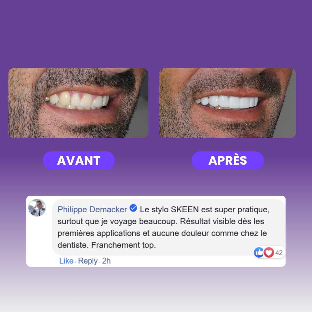 SKEEN™ - Stylo de Blanchiment Dentaire