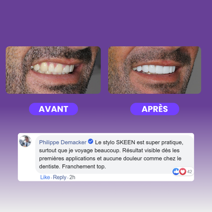 SKEEN™ - Stylo de Blanchiment Dentaire